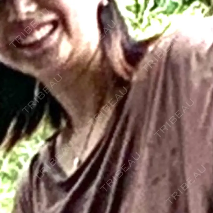 脂肪吸引（顔） / スネコス PRISM Beauty Clinic 町田院 BEFORE メイン用