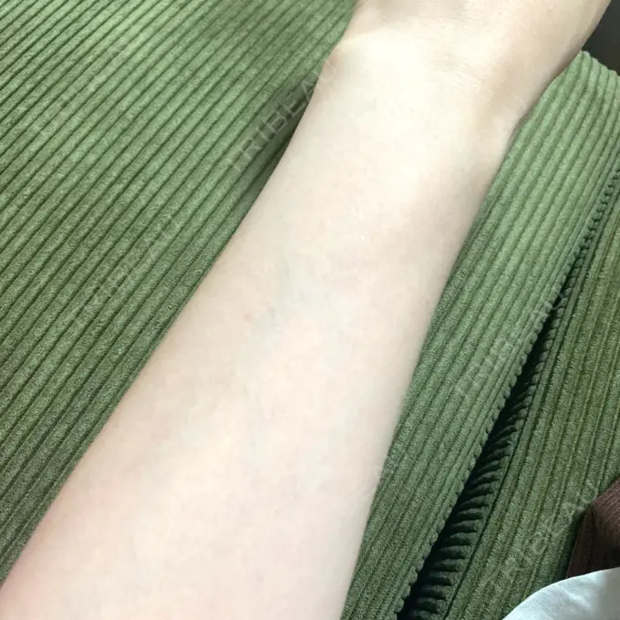 白玉点滴・注射 城本クリニック 池袋院 BEFORE メイン用