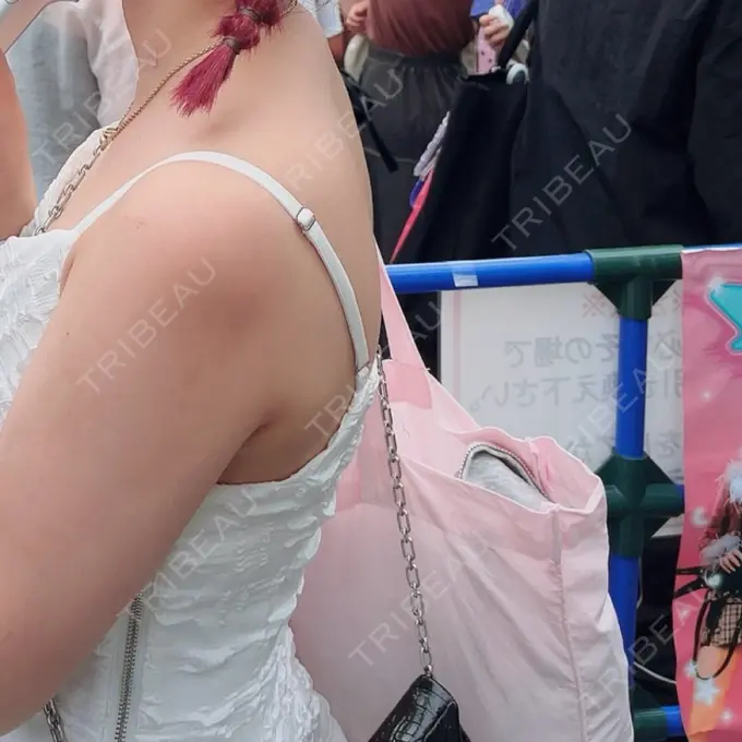 脂肪吸引（背中） ziz CLINIC BEFORE メイン用