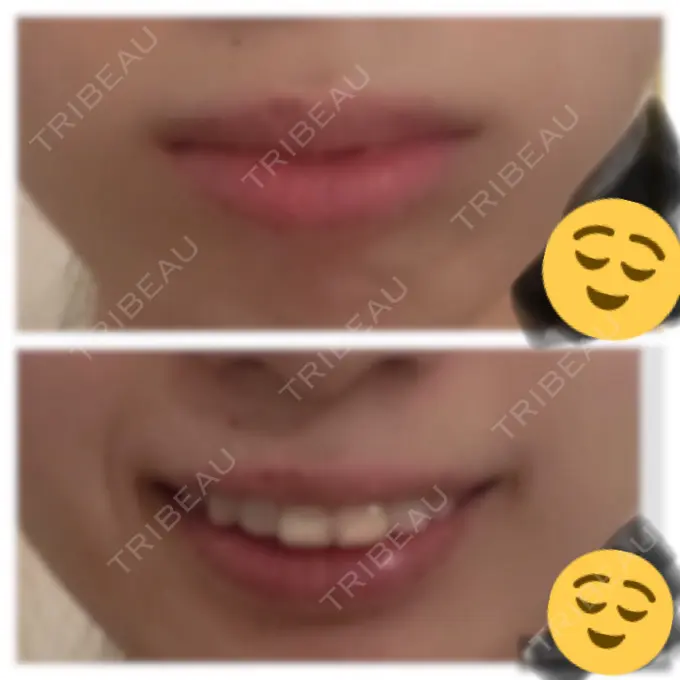 セットバック カトレア歯科・美容クリニック BEFORE メイン用