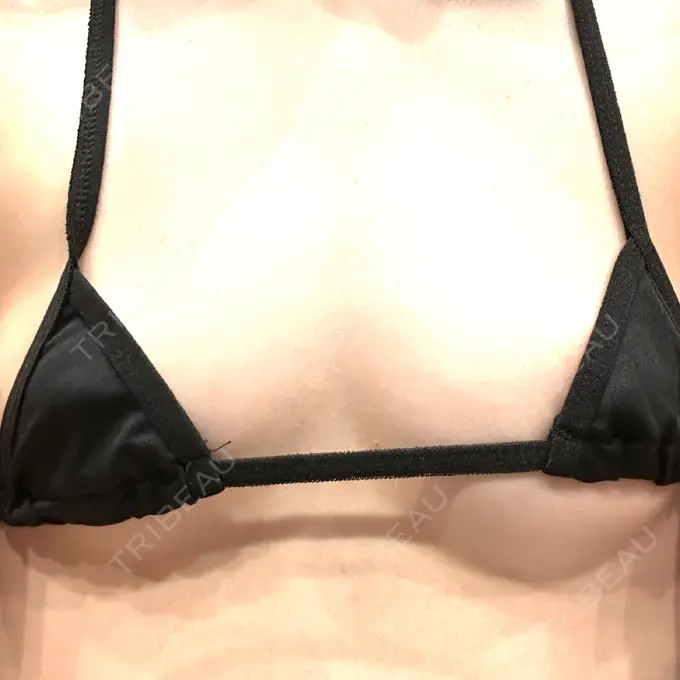 豊胸（シリコンバッグ） Code Beauty Clinic 名古屋院 BEFORE メイン用