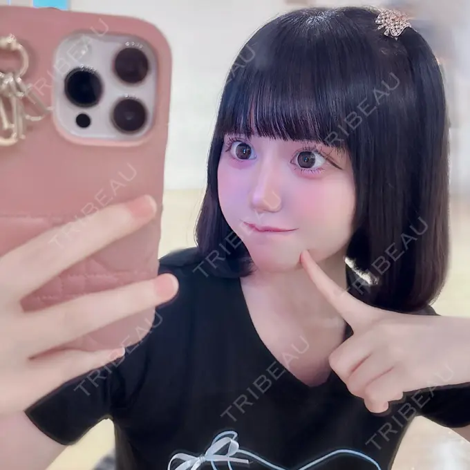 二重埋没 R Beauty CLINIC 銀座院 BEFORE メイン用