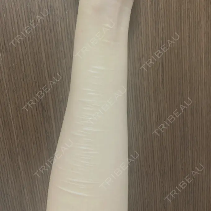 傷跡修正 きずときずあとのクリニック 銀座院 BEFORE メイン用