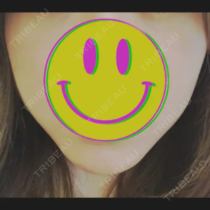 二重埋没 / 目頭切開 / ルフォー+ssro（両あご) / 輪郭修正 View美容整形外科 BEFORE メイン用