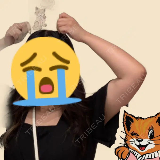 脂肪吸引（二の腕） アムルーズ美容外科クリニック 横浜院 BEFORE メイン用