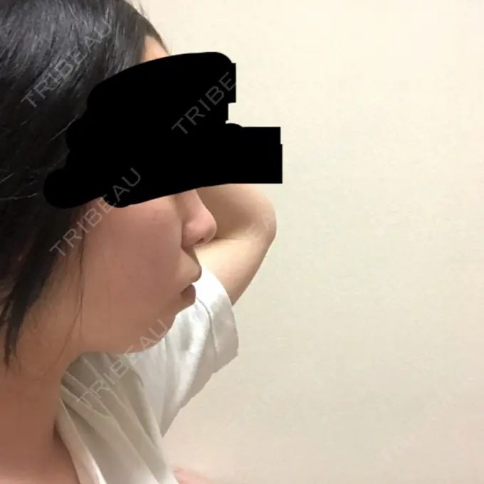 セットバック 大塚美容形成外科・歯科 大塚本院 BEFORE メイン用