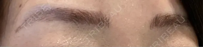 アートメイク（眉） 共立美容外科 大分院 BEFORE メイン用