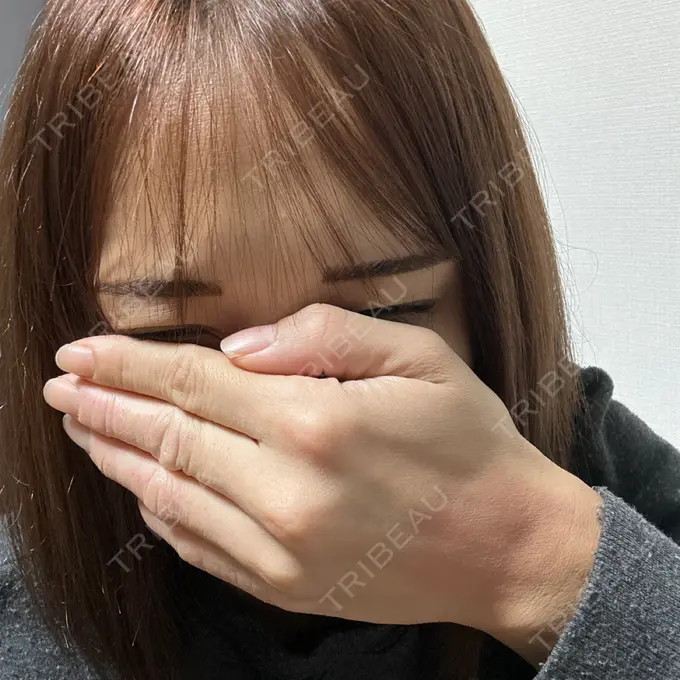 アートメイク（唇） しんゆり美容健康クリニック BEFORE メイン用