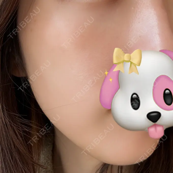 美肌レーザー / 美白レーザー / ピコレーザートーニング（美白・肝斑） 銀座みゆき通り美容外科 大阪梅田院 BEFORE メイン用