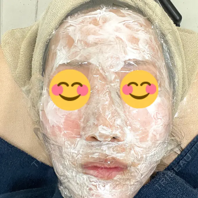 エレクトロポレーション / ヴェルヴェットスキン ミニマムスキンクリニック池袋 BEFORE メイン用