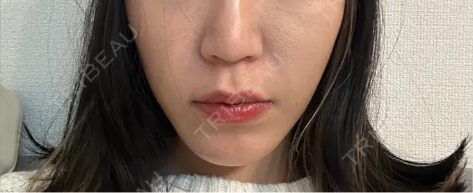 人中短縮 Otus Clinic 【オータスクリニック】 BEFORE メイン用