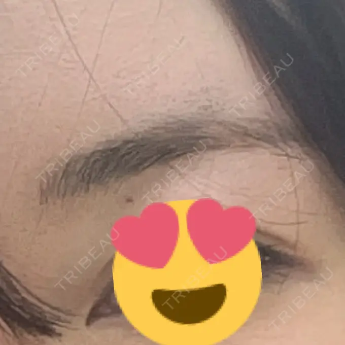 アートメイク（眉） しんゆり美容健康クリニック BEFORE メイン用