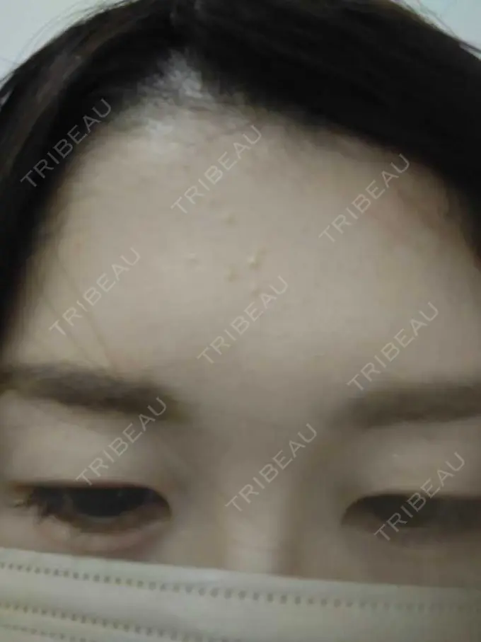 その他（肌） おおしま皮膚科 BEFORE メイン用