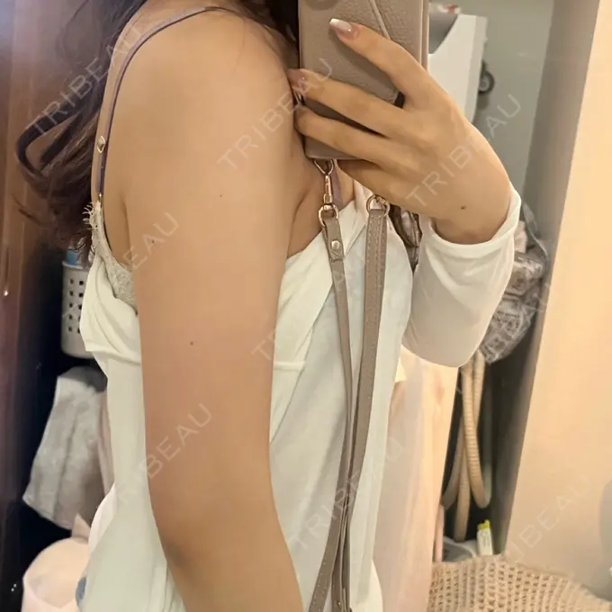 脂肪吸引（二の腕） / 脂肪吸引（肩） 4Dクリニック BEFORE メイン用