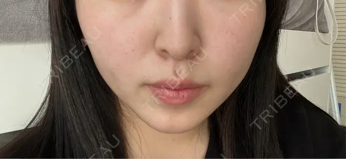 ルメッカ 表参道メディカルクリニック 表参道院 BEFORE メイン用