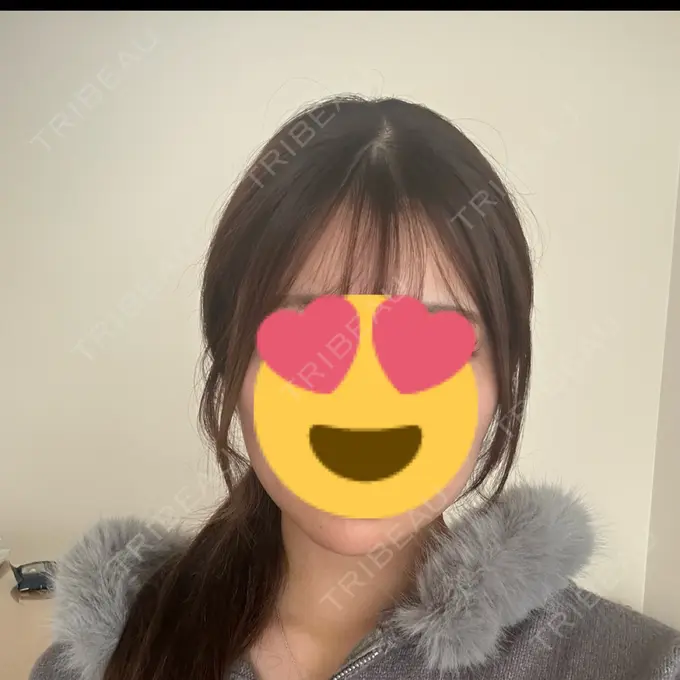 ボトックス（エラ・小顔） 共立美容外科 名古屋院 BEFORE メイン用