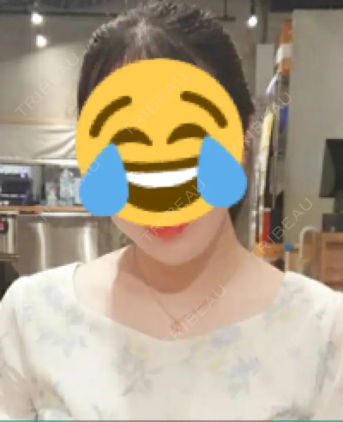 ボトックス（肩） 洗足整形・形成外科 BEFORE メイン用