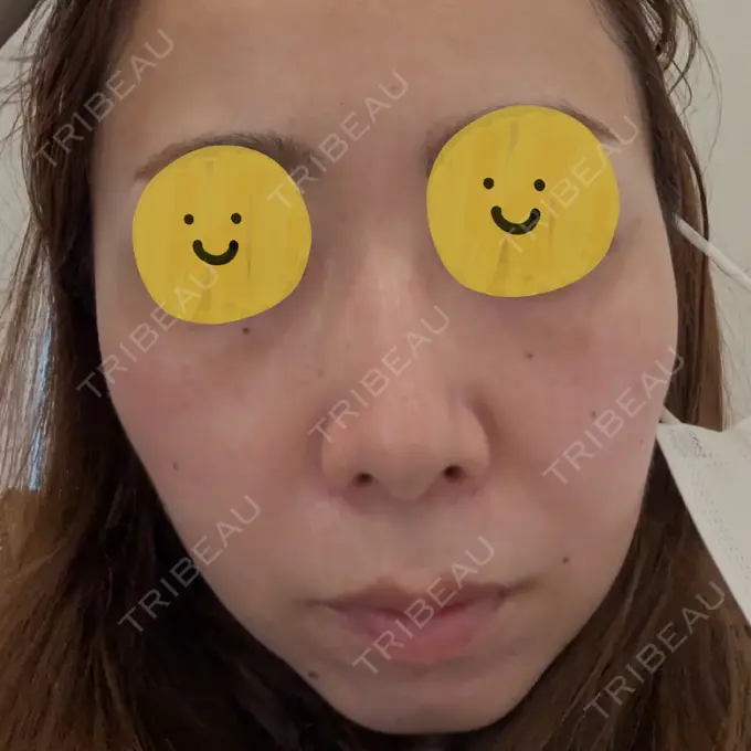 リジュラン しんゆり美容健康クリニック BEFORE メイン用