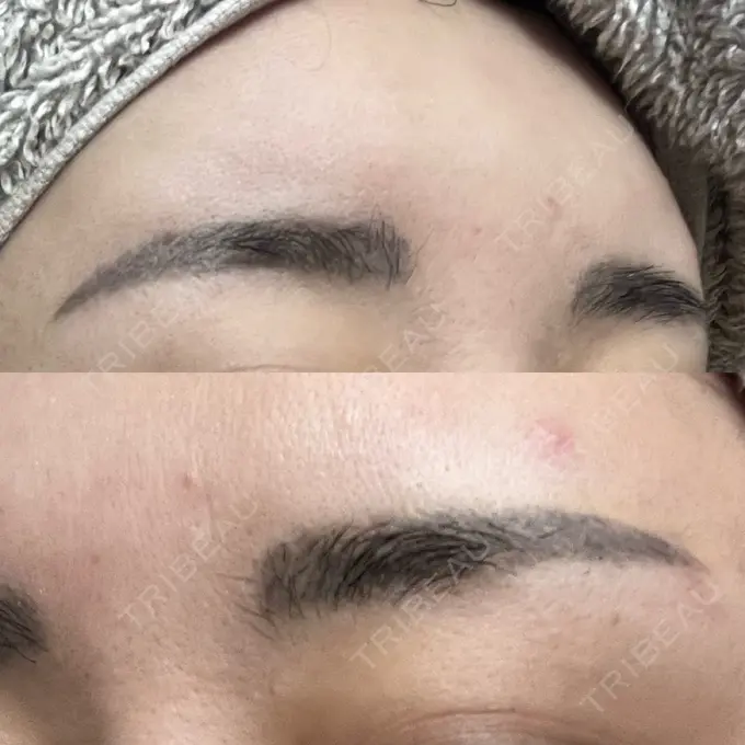 アートメイク（眉） / アートメイク除去・修正 表参道メディカルクリニック 横浜院	 BEFORE メイン用
