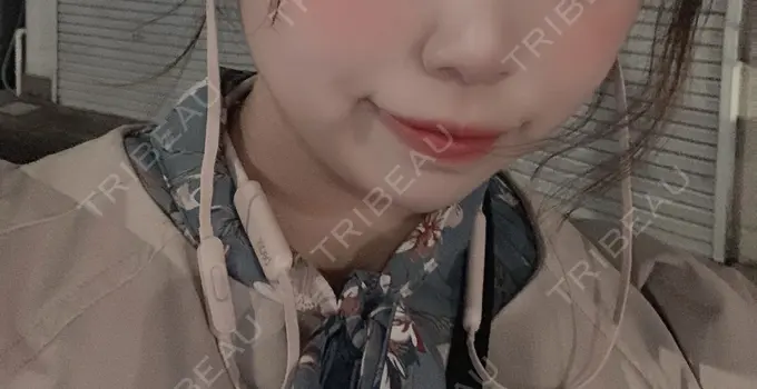 ヒアルロン酸注入（唇） ルラ美容クリニック 高田馬場院 BEFORE メイン用