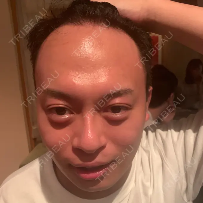 その他（輪郭） スタート整形外科 BEFORE メイン用