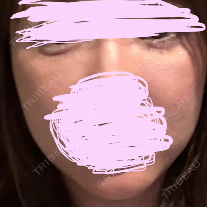 ルメッカ REDLINE CLINIC BEFORE メイン用