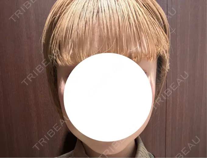 ボトックス（エラ・小顔） 湘南美容クリニック 横浜院 BEFORE メイン用