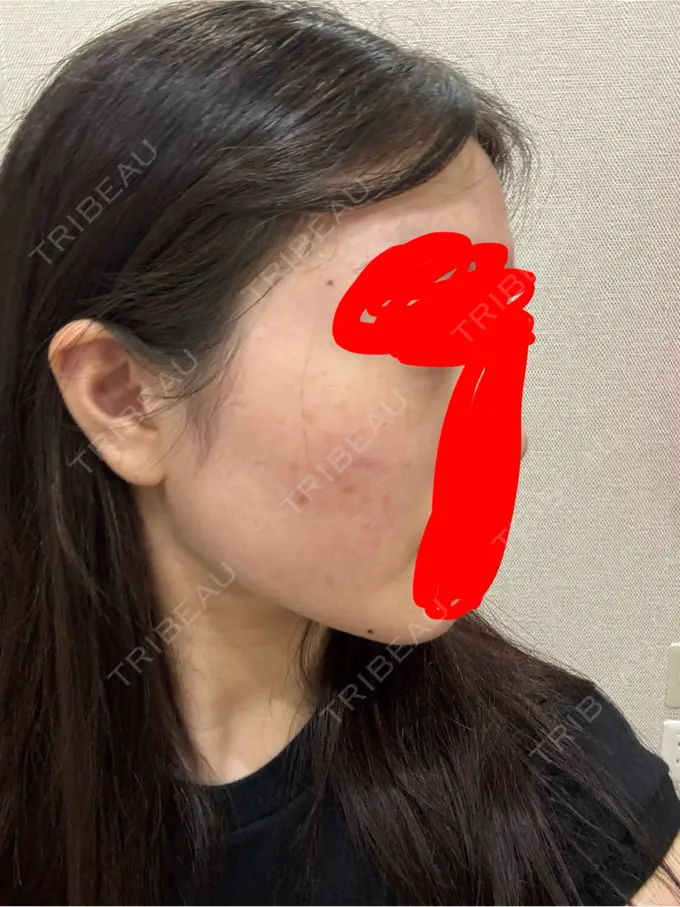 ポテンツァ 表参道メディカルクリニック 表参道院 BEFORE メイン用