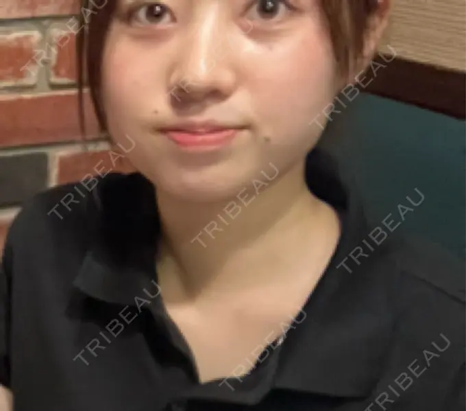 ヒアルロン酸注入（あご） / ボトックス（肩） HAAB BEAUTY CLINIC 名古屋院 BEFORE メイン用