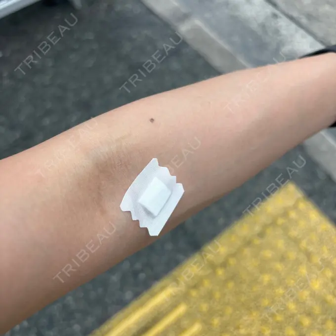 白玉点滴・注射 城本クリニック 名古屋院 BEFORE メイン用