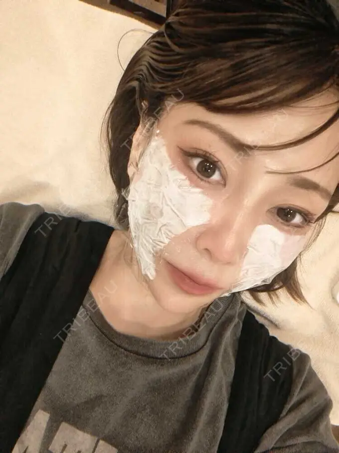 その他（目元） 新宿Ladies&Gentlemen美容クリニック BEFORE メイン用