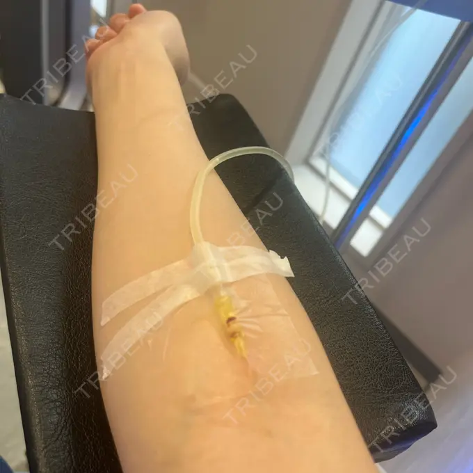 白玉点滴・注射 / 高濃度ビタミンC点滴 銀座中央クリニック BEFORE メイン用