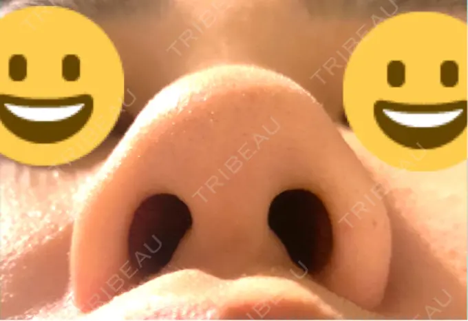 軟骨移植 / 鼻尖縮小 もとび美容外科クリニック 新宿院 BEFORE メイン用