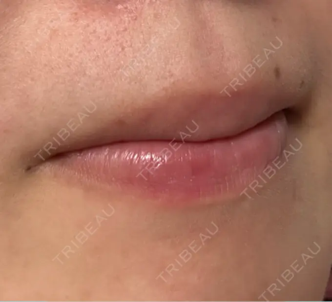 その他 ガーデンクリニック 名古屋院 BEFORE メイン用