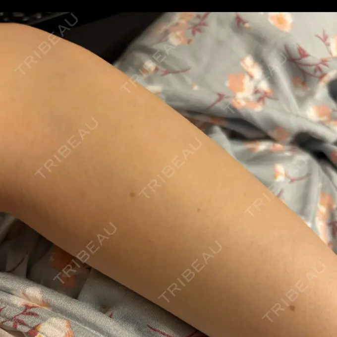 白玉点滴・注射 30クリニック BEFORE メイン用