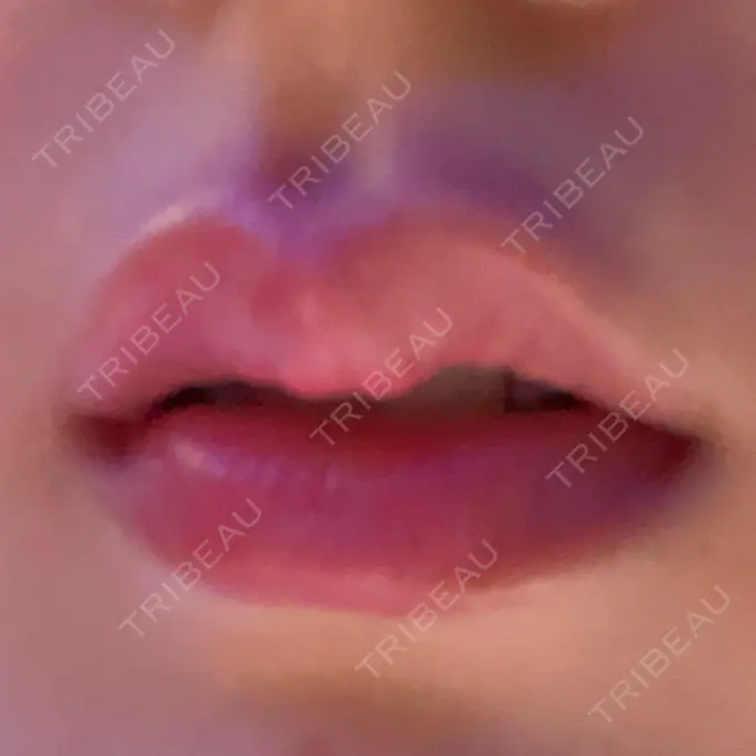 アートメイク（眉） Tokyo Tensei Clinic 新宿院 BEFORE メイン用