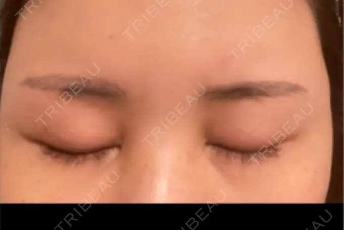 アートメイク（眉） ルーチェクリニック 銀座院 BEFORE メイン用