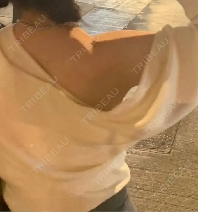 ボトックス（あご） / ボトックス（エラ・小顔） / ボトックス（肩） ルラ美容クリニック 大阪本院 BEFORE メイン用