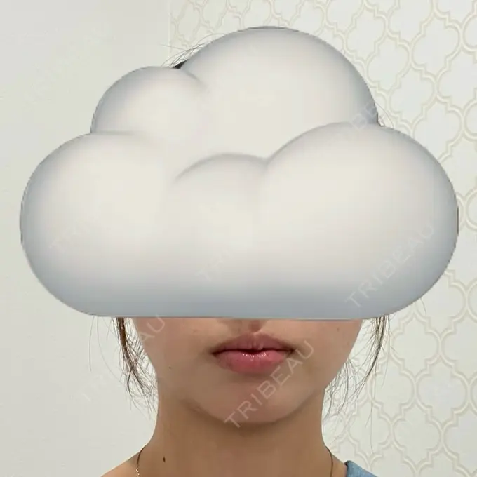 ボトックス（あご） / ヒアルロン酸注入（あご） / ヒアルロン酸注入（唇） BELINDA CLINIC（ベリンダクリニック）岡山院 BEFORE メイン用