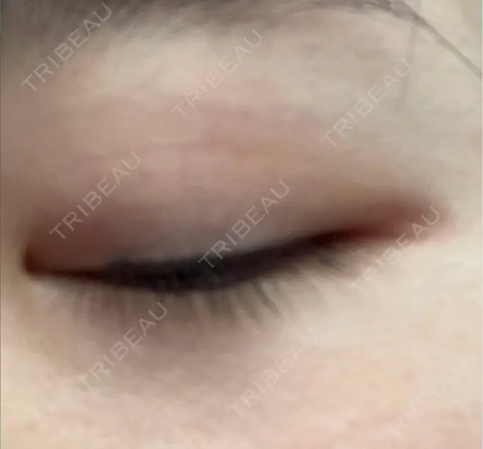 アートメイク（アイライン） BISIN GINZA CLINIC BEFORE メイン用