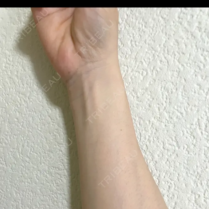 その他（肌） 城本クリニック 立川院 BEFORE メイン用