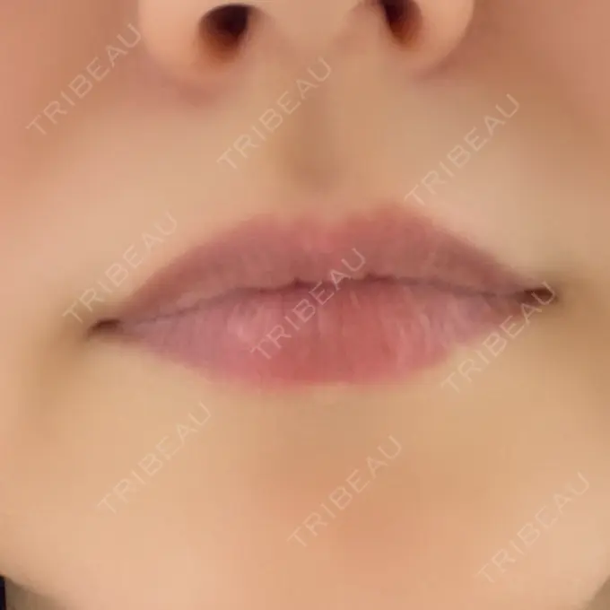 アートメイク（唇） ルーチェクリニック 銀座院 BEFORE メイン用