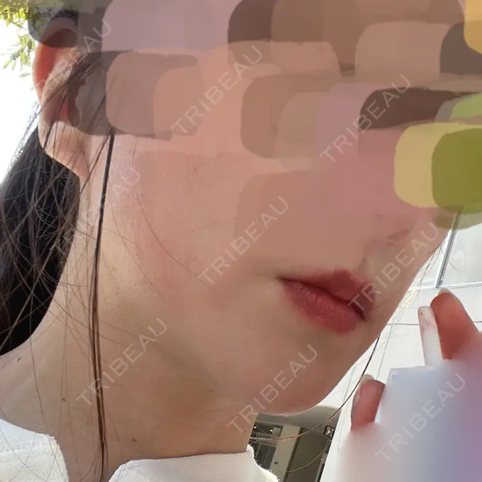 その他（肌） ルラ美容クリニック 仙台院 / ルラスキンクリニック 仙台院 BEFORE メイン用