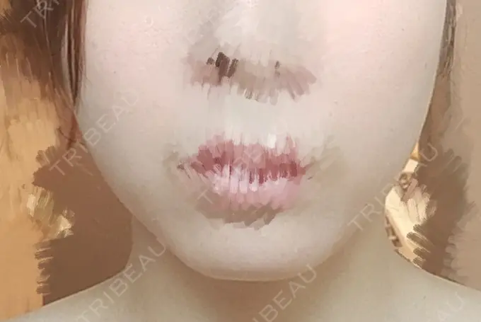 その他（輪郭） BITO BEAUTY CLINIC BEFORE メイン用