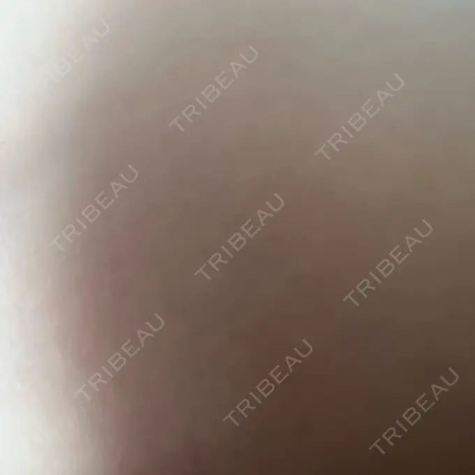 水光注射（ハリ・美肌） くさのたろうクリニック BEFORE メイン用