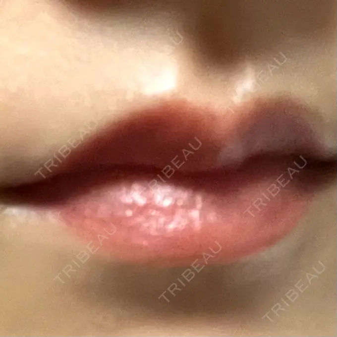 アートメイク（唇） Tokyo Tensei Clinic 新宿院 BEFORE メイン用
