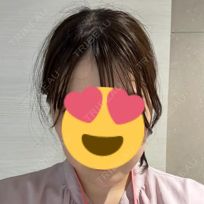 RF（高周波）たるみ治療 / その他（輪郭） Clinic K Blossom BEFORE メイン用