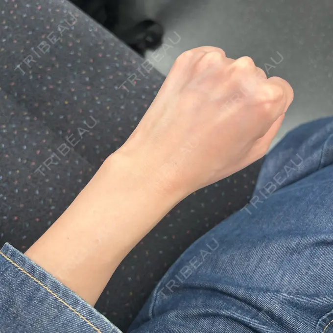 白玉点滴・注射 Natural Skin Clinic 自由ヶ丘院 BEFORE メイン用