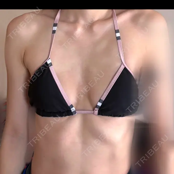 豊胸（シリコンバッグ） ルーチェクリニック 銀座院 BEFORE メイン用