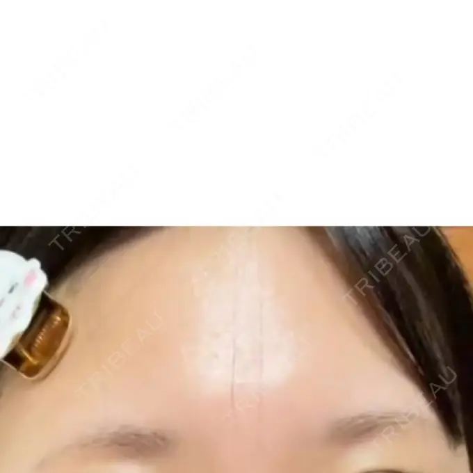 アートメイク（眉） 平和台皮フ科 BEFORE メイン用